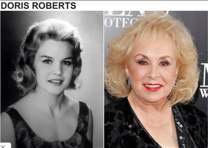 Doris Roberts Biography, Age, Height, Husband, Net Worth, Family