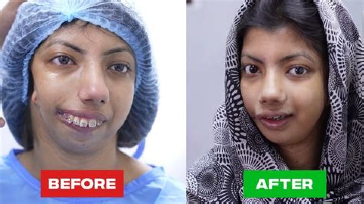 Has Mike Myers Done Plastic Surgery ?Then Vs Now Photos