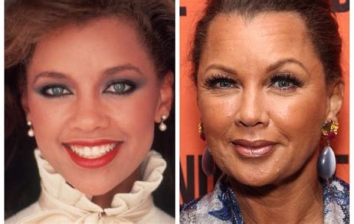 Plastic Surgery Experts Say Vanessa Williams Has Had More Than Just Botox Done (EXCLUSIVE)