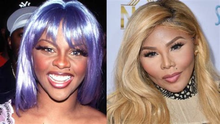 Plastic Surgery?See Lil’ Kim’s Shocking Transformation Right Before Your Eyes